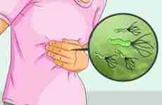 Хеликобактер пилори Helicobacter pylori